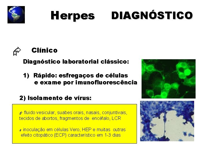 Herpes DIAGNÓSTICO Clínico Diagnóstico laboratorial clássico: 1) Rápido: esfregaços de células e exame por