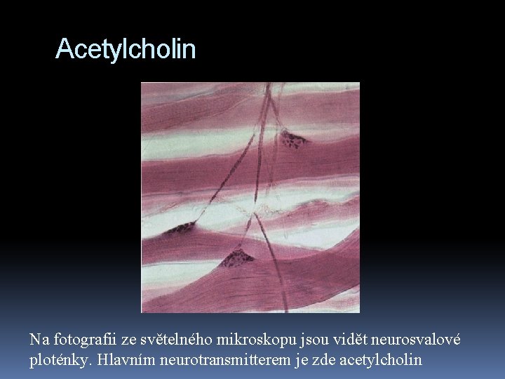 Acetylcholin Na fotografii ze světelného mikroskopu jsou vidět neurosvalové ploténky. Hlavním neurotransmitterem je zde