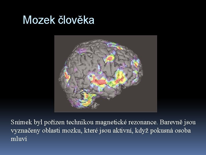 Mozek člověka Snímek byl pořízen technikou magnetické rezonance. Barevně jsou vyznačeny oblasti mozku, které