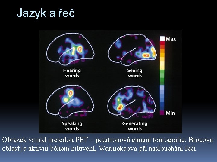 Jazyk a řeč Obrázek vznikl metodou PET – pozitronová emisní tomografie: Brocova oblast je