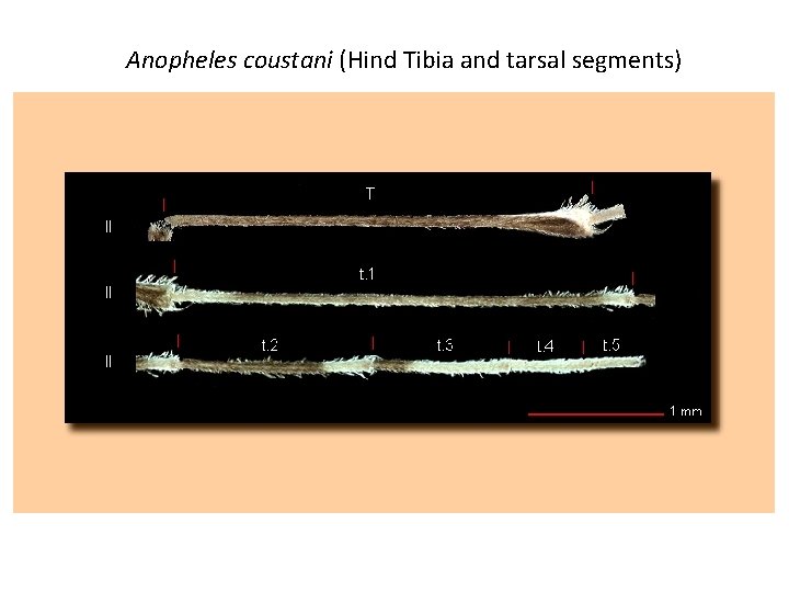 Anopheles coustani (Hind Tibia and tarsal segments) 