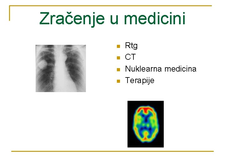 Zračenje u medicini n n Rtg CT Nuklearna medicina Terapije 