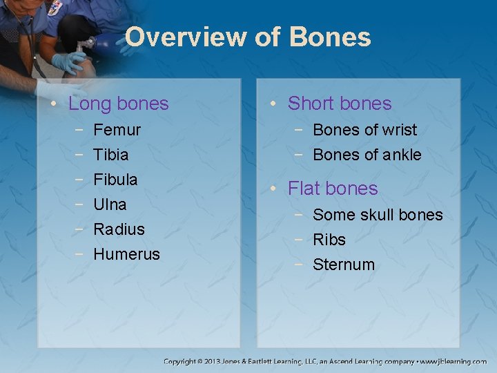 Overview of Bones • Long bones − − − Femur Tibia Fibula Ulna Radius Overview of Bones • Long bones − − − Femur Tibia Fibula Ulna Radius