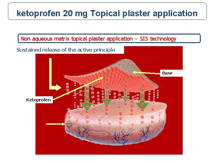 ketoprofen 20 mg Topical plaster application Non aqueous matrix topical plaster application - SIS