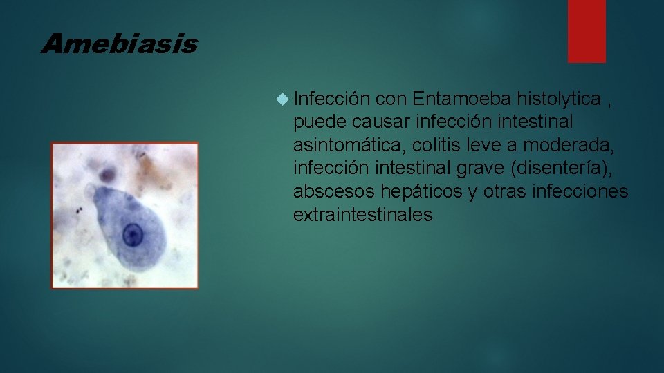 Amebiasis Infección con Entamoeba histolytica , puede causar infección intestinal asintomática, colitis leve a