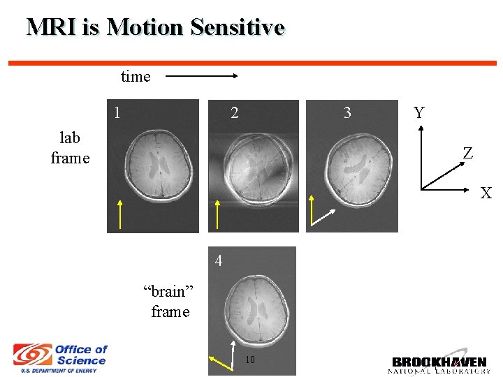 MRI is Motion Sensitive time 1 2 3 lab frame Y Z X 4