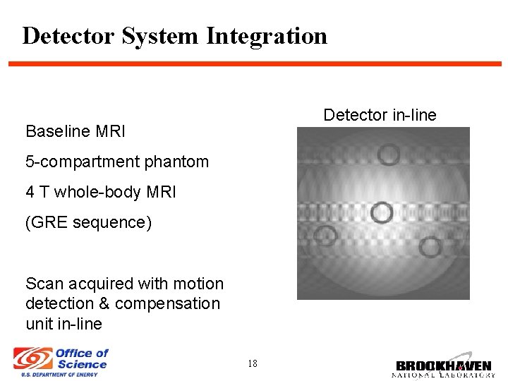 Detector System Integration Detector in-line Baseline MRI 5 -compartment phantom 4 T whole-body MRI