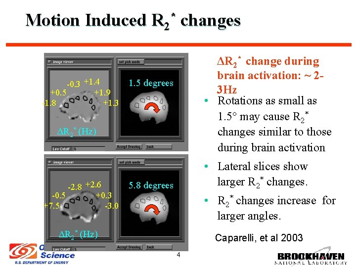Motion Induced R 2* changes -0. 3 +1. 4 +0. 5 +1. 9 -1.