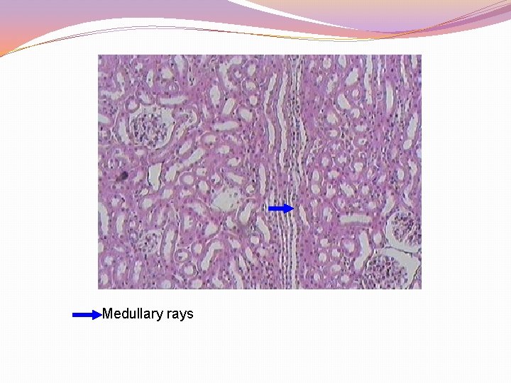 Medullary rays 
