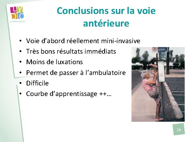 Conclusions sur la voie antérieure • • • Voie d’abord réellement mini-invasive Très bons