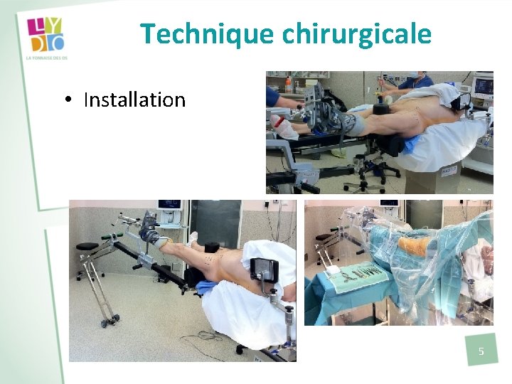 Technique chirurgicale • Installation 5 