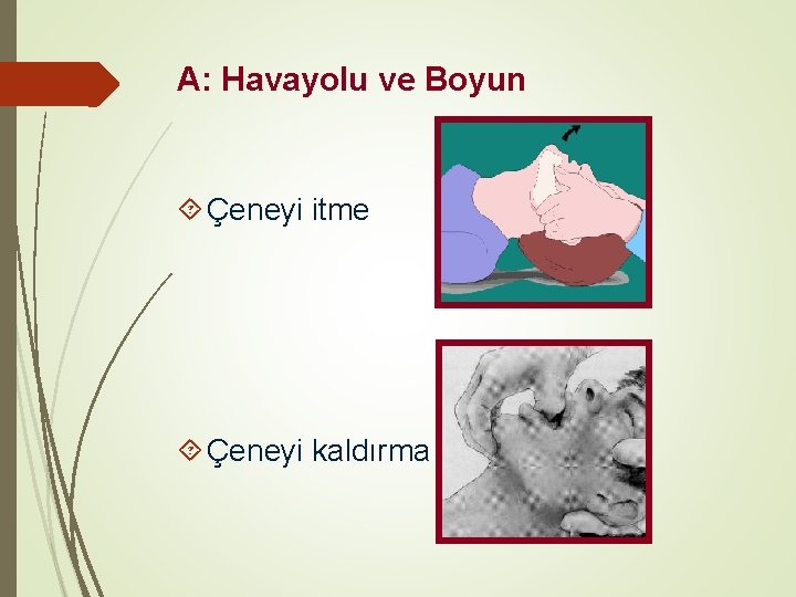 A: Havayolu ve Boyun Çeneyi itme Çeneyi kaldırma 