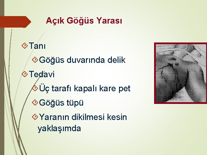 Açık Göğüs Yarası Tanı Göğüs duvarında delik Tedavi Üç tarafı kapalı kare pet Göğüs