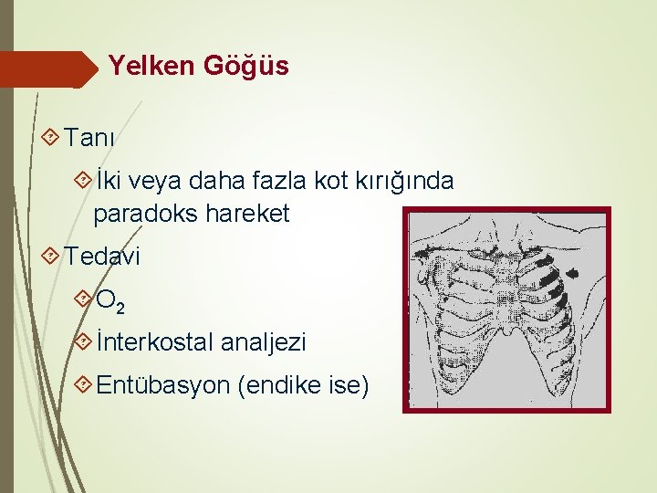 Yelken Göğüs Tanı İki veya daha fazla kot kırığında paradoks hareket Tedavi O 2