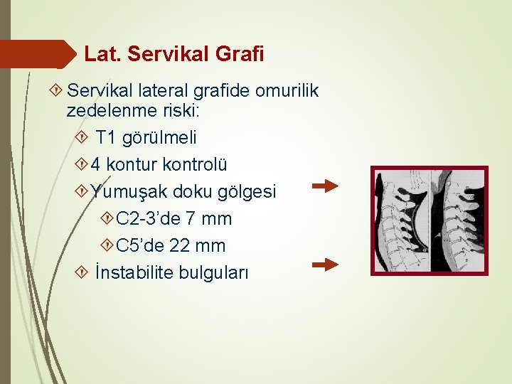 Lat. Servikal Grafi Servikal lateral grafide omurilik zedelenme riski: T 1 görülmeli 4 kontur