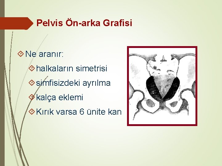 Pelvis Ön-arka Grafisi Ne aranır: halkaların simetrisi simfisizdeki ayrılma kalça eklemi Kırık varsa 6