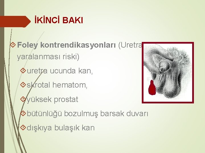 İKİNCİ BAKI Foley kontrendikasyonları (Uretra yaralanması riski) uretra ucunda kan, skrotal hematom, yüksek prostat