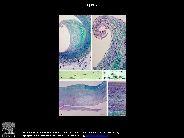 Figure 3 The American Journal of Pathology 2001 1581039 -1051 DOI: (10. 1016/S 0002