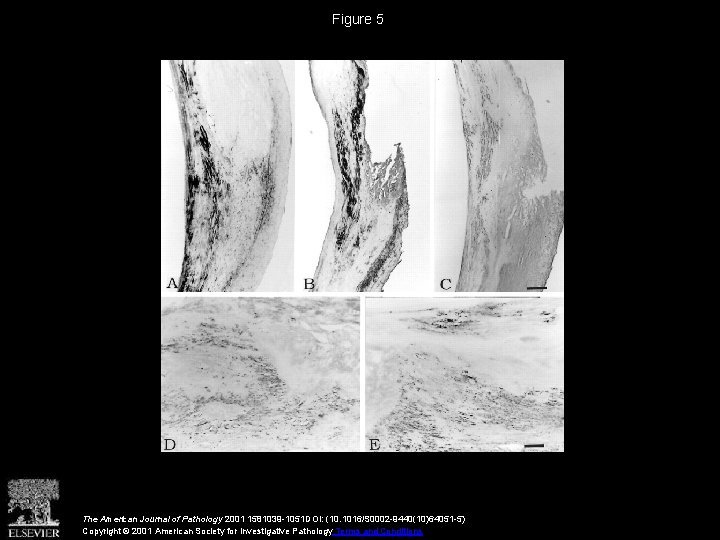 Figure 5 The American Journal of Pathology 2001 1581039 -1051 DOI: (10. 1016/S 0002