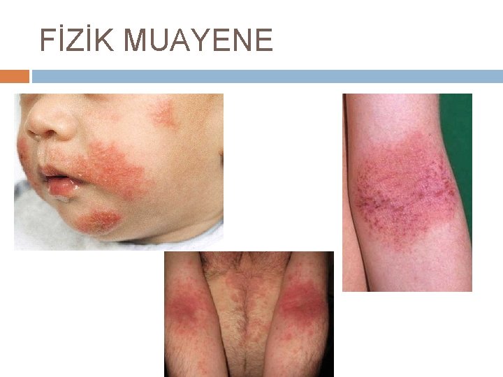 FİZİK MUAYENE 