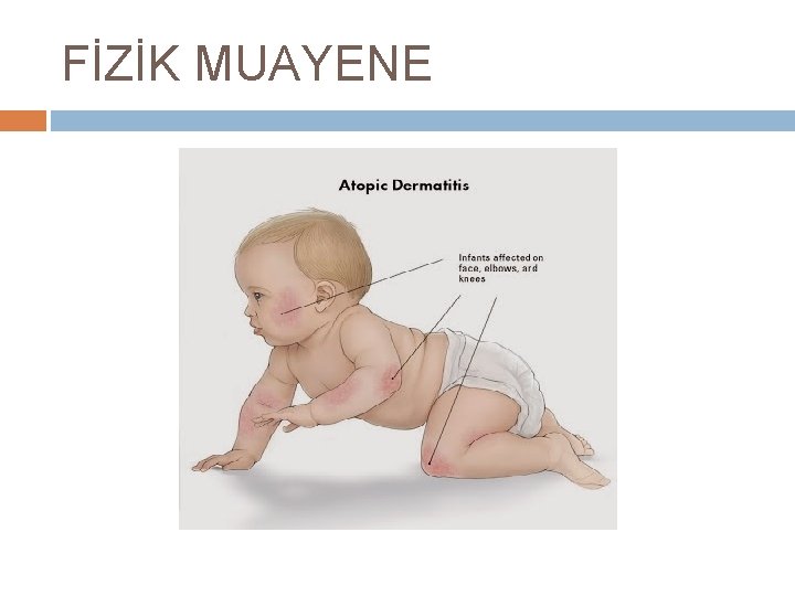 FİZİK MUAYENE 