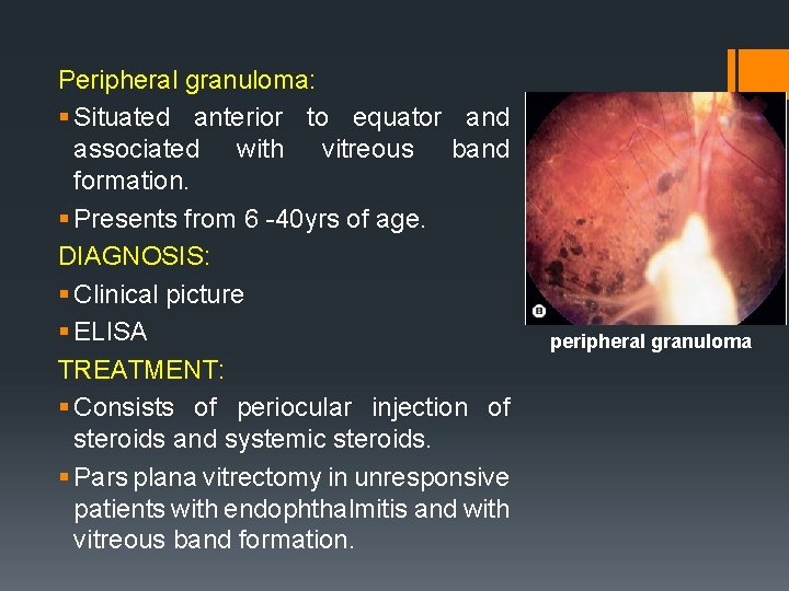 Peripheral granuloma: § Situated anterior to equator and associated with vitreous band formation. §