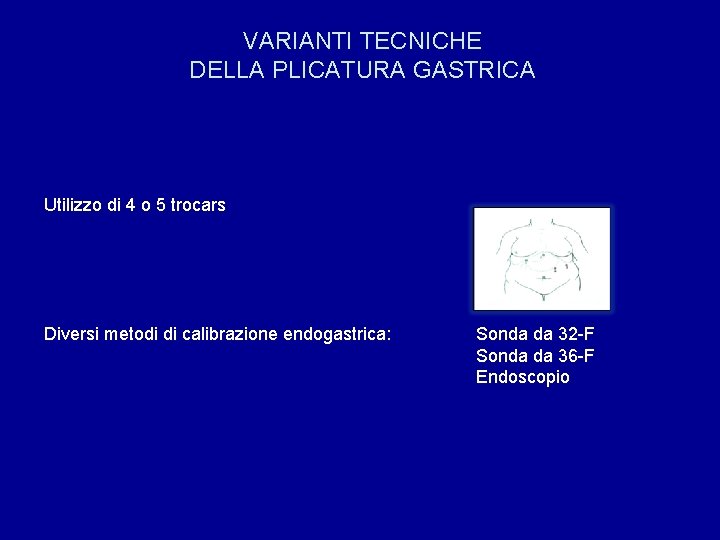 VARIANTI TECNICHE DELLA PLICATURA GASTRICA Utilizzo di 4 o 5 trocars Diversi metodi di