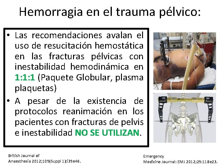 Hemorragia en el trauma pélvico: • Las recomendaciones avalan el uso de resucitación hemostática