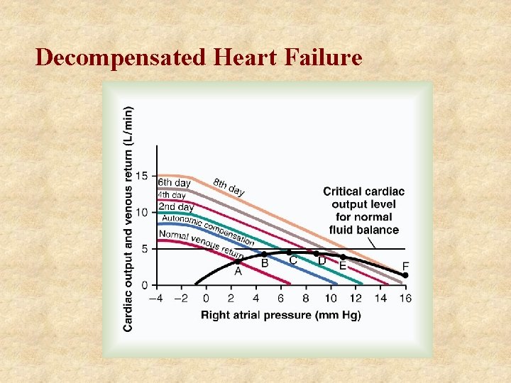 Decompensated Heart Failure 