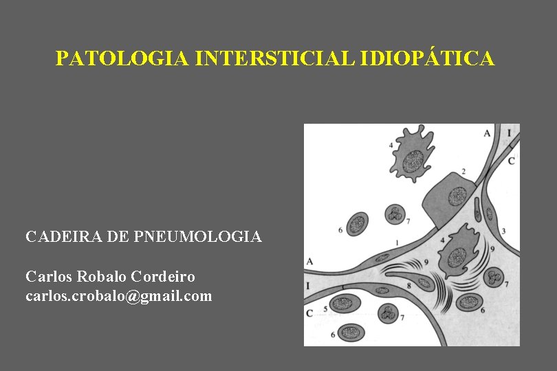 PATOLOGIA INTERSTICIAL IDIOPÁTICA CADEIRA DE PNEUMOLOGIA Carlos Robalo Cordeiro carlos. crobalo@gmail. com 