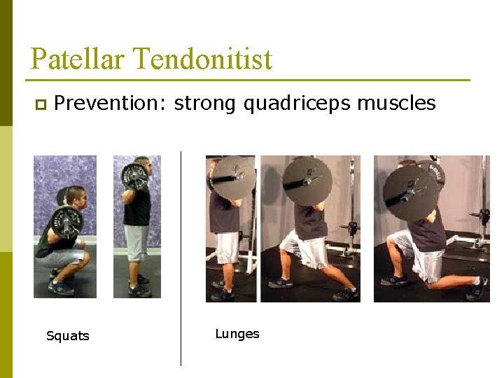 Patellar Tendonitist p Prevention: strong quadriceps muscles Squats Lunges 