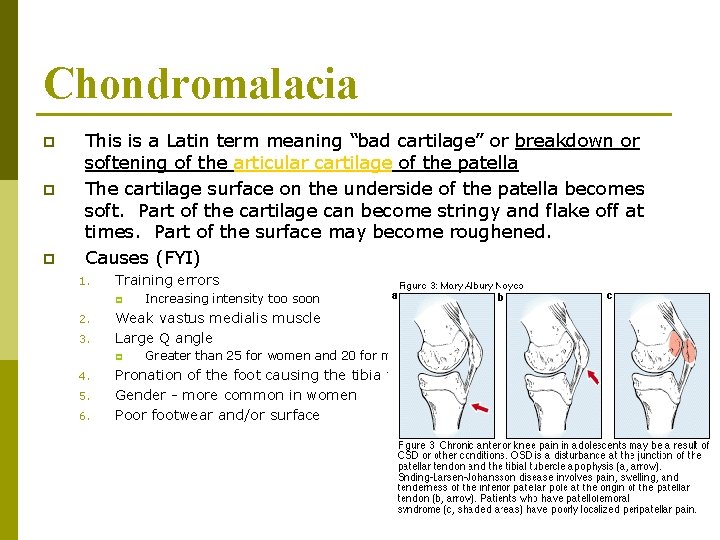 Chondromalacia p p p This is a Latin term meaning “bad cartilage” or breakdown