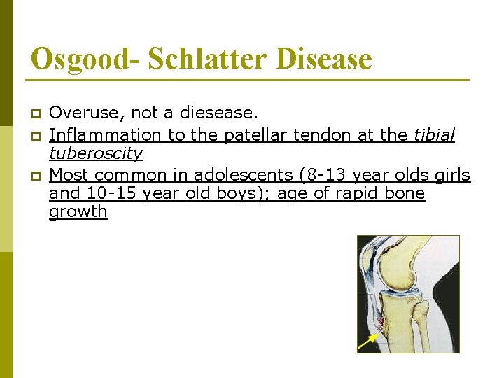 Osgood- Schlatter Disease p p p Overuse, not a diesease. Inflammation to the patellar