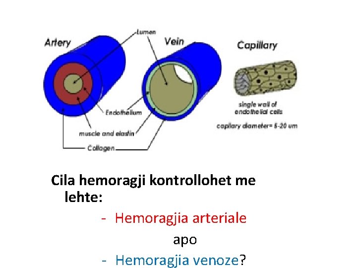 Cila hemoragji kontrollohet me lehte: - Hemoragjia arteriale apo - Hemoragjia venoze? 