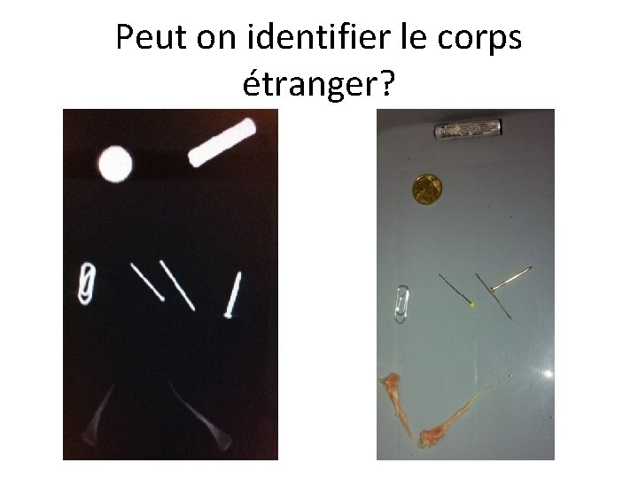 Peut on identifier le corps étranger? 