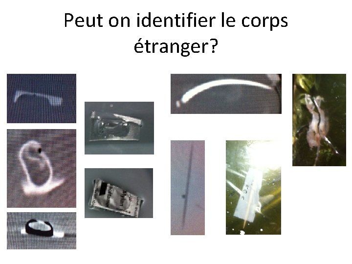 Peut on identifier le corps étranger? 