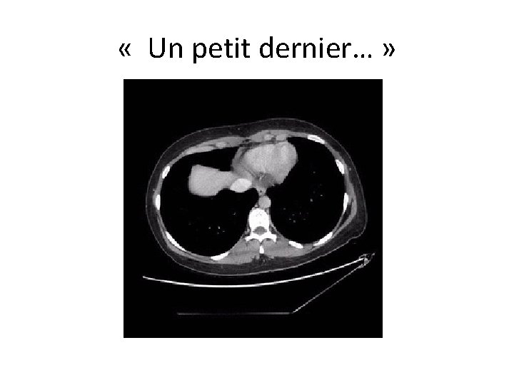  « Un petit dernier… » 