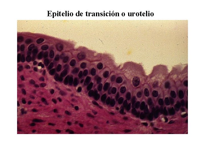 Epitelio de transición o urotelio 