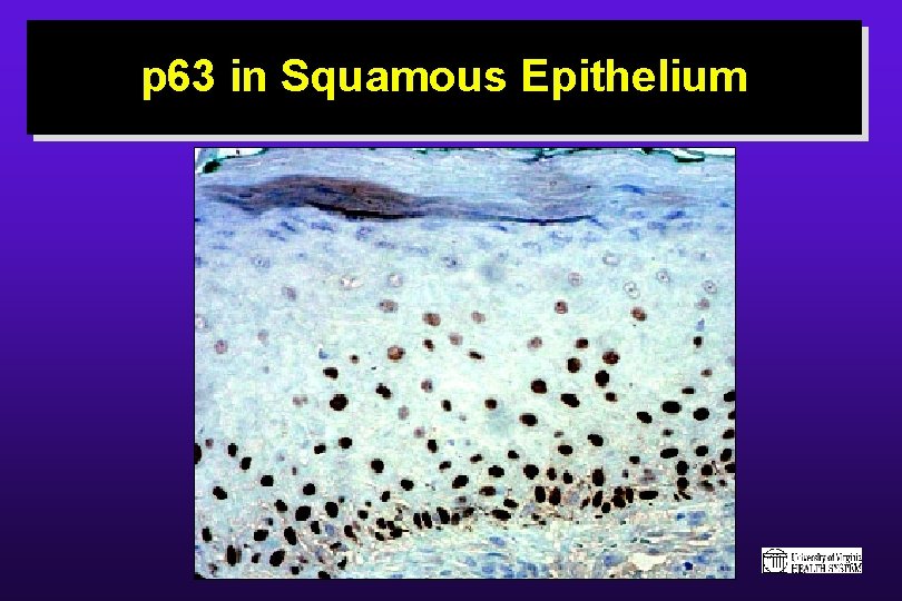 p 63 in Squamous Epithelium 