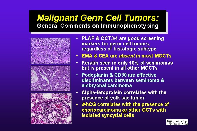 Malignant Germ Cell Tumors: General Comments on Immunophenotyping • PLAP & OCT 3/4 are