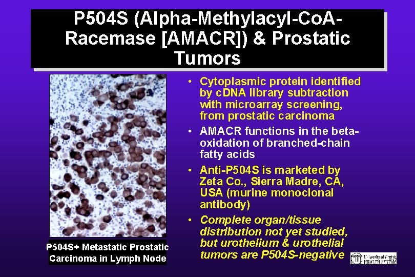 P 504 S (Alpha-Methylacyl-Co. ARacemase [AMACR]) & Prostatic Tumors P 504 S+ Metastatic Prostatic