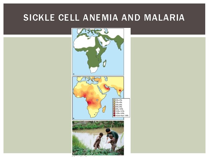 SICKLE CELL ANEMIA AND MALARIA 