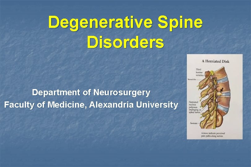 Degenerative Spine Disorders Department of Neurosurgery Faculty of Medicine, Alexandria University 