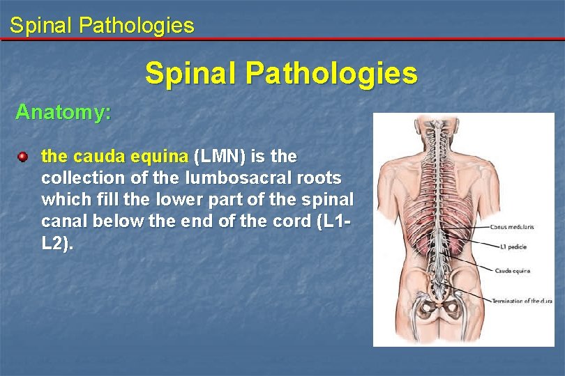 Spinal Pathologies Anatomy: the cauda equina (LMN) is the collection of the lumbosacral roots