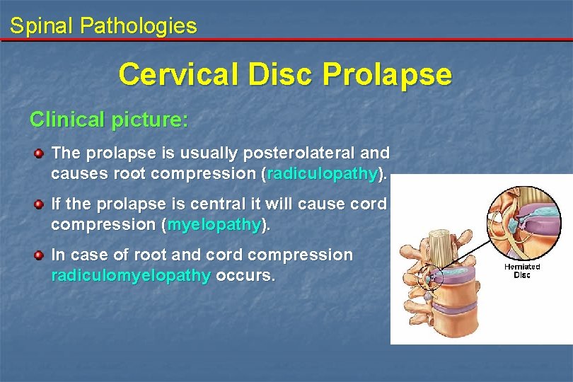 Spinal Pathologies Cervical Disc Prolapse Clinical picture: The prolapse is usually posterolateral and causes