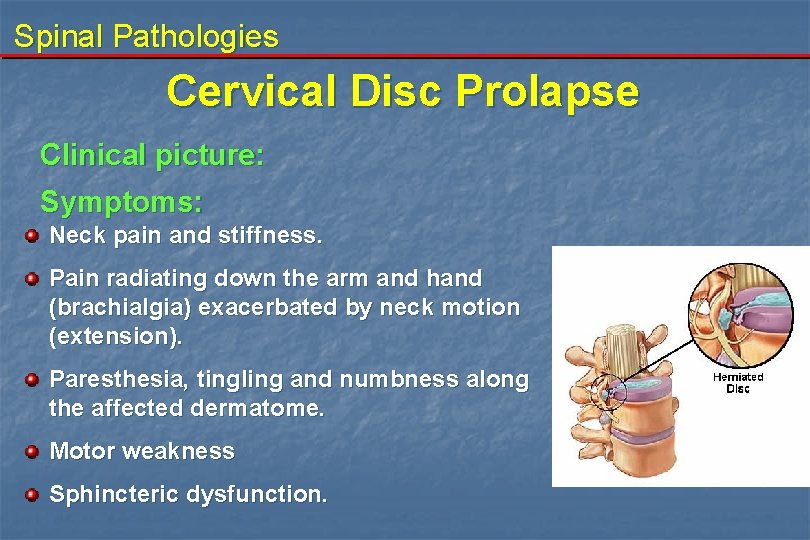 Spinal Pathologies Cervical Disc Prolapse Clinical picture: Symptoms: Neck pain and stiffness. Pain radiating