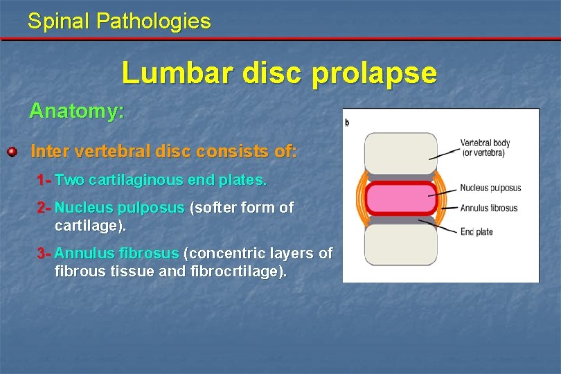 Spinal Pathologies Lumbar disc prolapse Anatomy: Inter vertebral disc consists of: 1 - Two