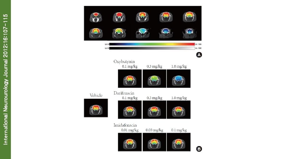 International Neurourology Journal 2012; 16: 107 -115 