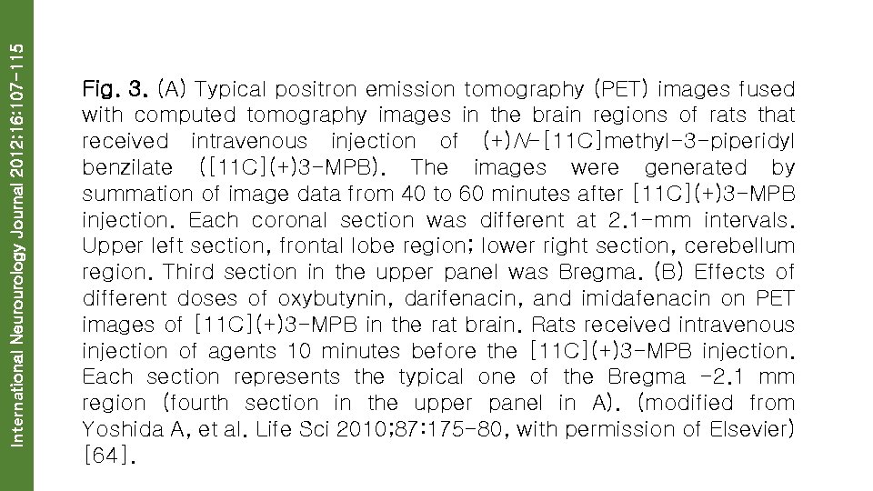 International Neurourology Journal 2012; 16: 107 -115 Fig. 3. (A) Typical positron emission tomography