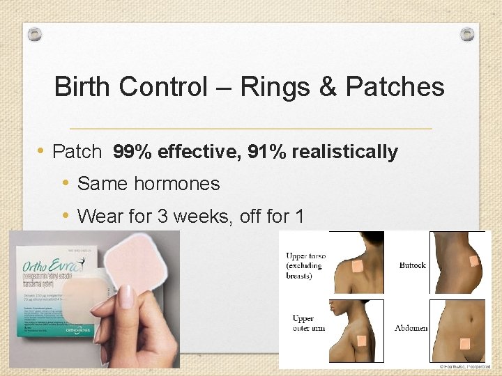 Birth Control – Rings & Patches • Patch 99% effective, 91% realistically • Same